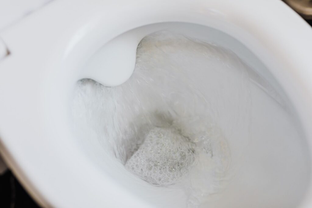 why does my toilet keep running